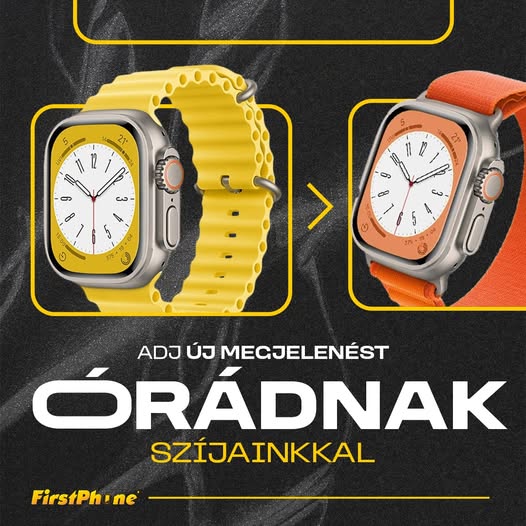 💫 Welches Apple-Watch-Armband passt zu dir? ⌚
